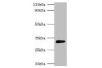 Western blot<br />
All lanes:Glutaminase 1 antibody at 2ug/ml+DH5 alpha; whole cell lysate<br />
Secondary<br />
Goat polyclonal to rabbit at 1/10000 dilution<br />
Predicted band size: 33kDa<br />
Observed band size: 33kDa<br />