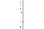 Gel: 10%SDS-PAGE, Lysate: 40 