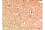 Immunohistochemical analysis of paraffin-embedded Human Skeletal Muscle Tissue using ATG13 Rabbit pAb diluted at 1:200