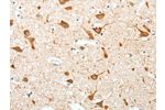 The image on the left is immunohistochemistry of paraffin-embedded Human brain tissue using CSB-PA311022(AKAP4 Antibody) at dilution 1/10, on the right is treated with fusion protein. (Original magnification: 