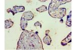 Immunohistochemistry of paraffin-embedded human placenta tissue using CSB-PA313364LA01HU at dilution 1:100