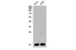 Western blot analysis of HELA A549 Cell Lysate, antibody was diluted at 1:1000