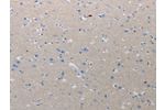 The image on the left is immunohistochemistry of paraffin-embedded Human urinary bladder tissue using CSB-PA313736(CMTM1 Antibody) at dilution 1/10, on the right is treated with synthetic peptide. (Original magnification: 
