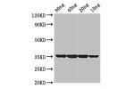 Western Blot<br />
Positive WB detected in Recombinant protein<br />
All lanes:dps antibody at 2