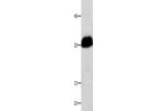 Gel: 12+15%SDS-PAGE, Lysate: 40 