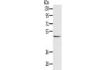 Gel: 8%SDS-PAGE, Lysate: 40 