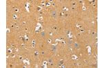 The image on the left is immunohistochemistry of paraffin-embedded Human brain tissue using CSB-PA319466(DNM3 Antibody) at dilution 1/20, on the right is treated with fusion protein. (Original magnification: 