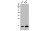 Western blot analysis of mouse-brain mouse-spinal-cord lysate, antibody was diluted at 2000. Secondary antibody  was diluted at 1:20000