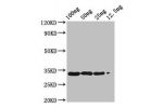 Western Blot<br />
Positive WB detected in Recombinant protein<br />
All lanes:BETVIA antibody at 2.8