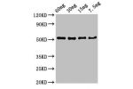 Western Blot<br />
Positive WB detected in Recombinant protein<br />
All lanes:D8L antibody at 3
