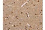 The image on the left is immunohistochemistry of paraffin-embedded Human brain tissue using CSB-PA324006(DLD Antibody) at dilution 1/35, on the right is treated with fusion protein. (Original magnification: 