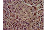 IHC image of CSB-PA325708LA01HU diluted at 1:500 and staining in paraffin-embedded human pancreatic tissue performed on a Leica BondTM system. After dewaxing and hydration, antigen retrieval was mediated by high pressure in a citrate buffer (pH 6.0). Sect