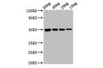 Western Blot<br />
Positive WB detected in Recombinant protein<br />
All lanes:cysP antibody at 3