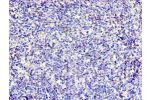 Immunohistochemistry of paraffin-embedded human thymus using CSB-PA326953ESR2HU at dilution 1:100