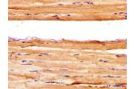 IHC image of CSB-PA326981LA01HU diluted at 1:400 and staining in paraffin-embedded human skeletal muscle tissue performed on a Leica BondTM system. After dewaxing and hydration, antigen retrieval was mediated by high pressure in a citrate buffer (pH 6.0).