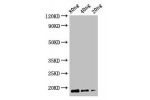 Western Blot<br />
Positive WB detected in Recombinant protein<br />
All lanes:CDGT2 antibody at 2.5