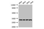Western Blot<br />
Positive WB detected in Recombinant protein<br />
All lanes:BLIP antibody at 4