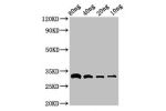 Western Blot<br />
Positive WB detected in Recombinant protein<br />
All lanes:bla antibody at 3
