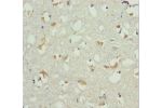 Immunohistochemistry of paraffin-embedded human brain tissue using CSB-PA335050DSR1HU at dilution 1:100
