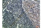 Immunohistochemical analysis of paraffin-embedded Human-tonsil, antibody was diluted at 1:100