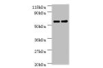 Western blot<br />
All lanes:Carboxylesterase 1C antibody at 2ug/ml<br />
Lane 1:mouse liver tissue<br />
Lane 2:Rat liver tissue<br />
Secondary<br />
Goat polyclonal to rabbit at 1/10000 dilution<br />
Predicted band size: 61kDa<br />
Observed band size