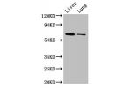 Western Blot<br />
Positive WB detected in:Mouse liver tissue,Rat lung tissue<br />
All lanes: Ces1c antibody at 5