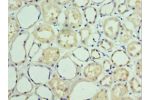 Immunohistochemistry of paraffin-embedded human kidney using CSB-PA342402ESR2HU at dilution 1:100