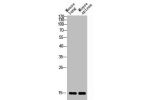 Western blot analysis of mouse-lung mouse-spleen lysis using BATF3 antibody. Antibody was diluted at 1:2000. Secondary antibody  was diluted at 1:20000