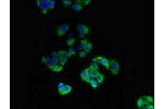 Immunofluorescent analysis of PC3 cells using CSB-PA344617LA01HU at a dilution of 1:100 and Alexa Fluor 488-congugated AffiniPure Goat Anti-Rabbit IgG(H+L)
