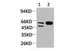 Western blot analysis of 1) Mouse Brain Tissue, 2)Rat Brain Tissue with GABA A Receptor a3 Rabbit pAb diluted at 1:2,000.