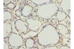 Immunohistochemistry of paraffin-embedded human thyroid tissue using CSB-PA349766LA01HU at dilution of 1:100