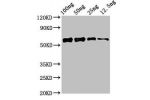 Western Blot<br />
Positive WB detected in Recombinant protein<br />
All lanes:ald1 antibody at 2.4