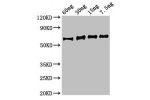 Western Blot<br />
Positive WB detected in Recombinant protein<br />
All lanes:eno antibody at 3.5