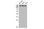 Western blot analysis of SH-SY5Y K562 HELA using RNase III Drosha antibody. Antibody was diluted at 1:1000. Secondary antibody  was diluted at 1:20000