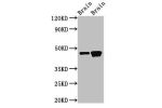 Western Blot<br />
Positive WB detected in:Rat brain tissue,Mouse brain tissue<br />
All lanes:GNAS antibody at 3