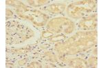 Immunohistochemistry of paraffin-embedded human kidney tissue using CSB-PA352689ESR1HU at dilution 1:100