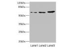 Western blot<br />
All lanes: ERVFRD-1 antibody at 3.93ug/ml<br />
Lane 1 : Hela whole cell lysate<br />
Lane 2 : HepG-2 whole cell lysate<br />
Lane 3 : A431 whole cell lysate<br />
Secondary<br />
Goat polyclonal to rabbit IgG at 1/10000 dilution<br />
