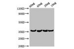 Western Blot<br />
Positive WB detected in Recombinant protein<br />
All lanes:Beta-lytic antibody at 3.2