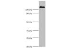 Western blot<br />
All lanes:Kurstaki Pesticidal crystal protein cry1Ac antibody at 2ug/ml+recombinant Kurstaki Pesticidal crystal protein cry1Ac protein at 1ugSecondary<br />
Goat polyclonal to rabbit at 1/10000 dilution<br />
Predicted band size: 133kDa