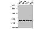 Western Blot<br />
Positive WB detected in Recombinant protein<br />
All lanes:eta antibody at 3