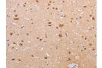 The image on the left is immunohistochemistry of paraffin-embedded Human brain tissue using CSB-PA358271(CLDN10 Antibody) at dilution 1/50, on the right is treated with synthetic peptide. (Original magnification: 