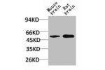 Western blot analysis of 1) Mouse Brain Tissue, 2)Rat Brain Tissue with GABA A Receptor a2 Rabbit pAb diluted at 1:2,000.