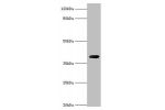 Western blot<br />
All lanes:Carboxypeptidase G2 antibody at 2ug/ml+recombinant Carboxypeptidase G2 protein at 0.5ugSecondary<br />
Goat polyclonal to rabbit at 1/10000 dilution<br />
Predicted band size: 38kDa<br />
Observed band size: 38kDa<br />