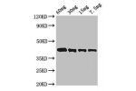 Western Blot<br />
Positive WB detected in Recombinant protein<br />
All lanes:Arginine antibody at 3