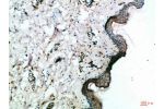 Immunohistochemical analysis of paraffin-embedded Human-skin, antibody was diluted at 1:100