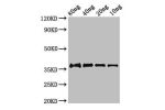Western Blot<br />
Positive WB detected in Recombinant protein<br />
All lanes:fbpC antibody at 2.8