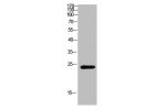 Western Blot analysis of mouse-brain cells using Antibody diluted at 800. Secondary antibody  was diluted at 1:20000