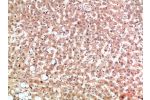 Immunohistochemical analysis of paraffin-embedded human-liver, antibody was diluted at 1:200
