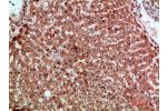 Immunohistochemical analysis of paraffin-embedded human-liver, antibody was diluted at 1:200