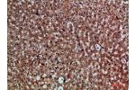 Immunohistochemical analysis of paraffin-embedded human-liver, antibody was diluted at 1:200